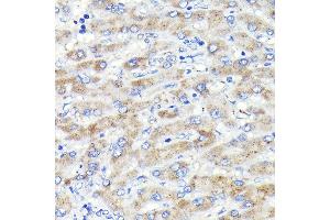 Immunohistochemistry of paraffin-embedded human liver using Glucosylceramidase beta (Glucosylceramidase beta (GBA)) Rabbit mAb (ABIN7267407) at dilution of 1:100 (40x lens). (GBA Antikörper)