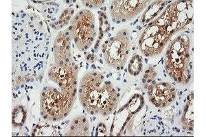 Image no. 1 for anti-Retinoic Acid Receptor Responder (Tazarotene Induced) 1 (RARRES1) antibody (ABIN1500601) (RARRES1 Antikörper)