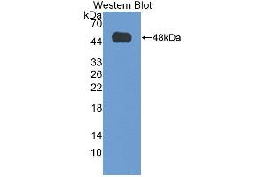 Western blot analysis of the recombinant protein. (VPS37A Antikörper  (AA 1-397))