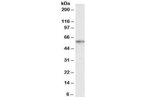 Western blot testing of K562 nuclear lysate with VRK2 antibody at 2ug/ml. (VRK2 Antikörper)