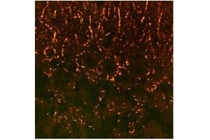 Immunohistochemistry (IHC) image for anti-Synaptophysin (SYP) (N-Term) antibody (ABIN2782216)