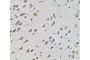 Immunohistochemistry of paraffin-embedded Rat brain using FoxO3a Polyclonal Antibody at dilution of 1:100 (40x lens). (FOXO3 Antikörper)