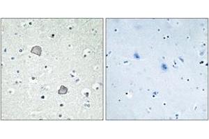 Immunohistochemistry analysis of paraffin-embedded human brain tissue, using EDG2 Antibody. (BUD31 Antikörper  (AA 5-54))