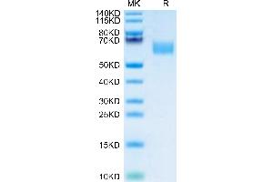 SDS-PAGE (SDS) image for CD47 (CD47) (AA 19-140) protein (Fc Tag) (ABIN7274242)