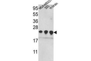 Western Blotting (WB) image for anti-Peroxiredoxin 2 (PRDX2) antibody (ABIN3001720) (Peroxiredoxin 2 Antikörper)