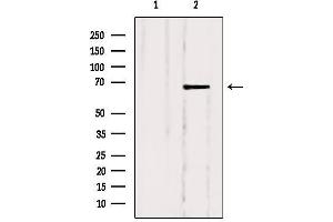 Western blot analysis of extracts from Hela, using SLC5A6 Antibody.