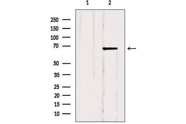 SLC5A6 anticorps  (C-Term)