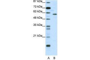 WB Suggested Anti-YY1  Antibody Titration: 0. (YY1 Antikörper  (N-Term))