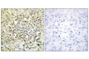 Immunohistochemistry (IHC) image for anti-Cyclin-Dependent Kinase-Like 4 (CDKL4) (C-Term) antibody (ABIN1849692) (CDKL4 Antikörper  (C-Term))