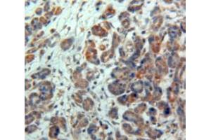 Used in DAB staining on fromalin fixed paraffin-embedded Pancreas tissue (NPTX2 Antikörper)