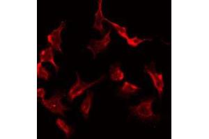 ABIN6277981 staining Hela by IF/ICC. (PRKAR2B Antikörper  (Internal Region))