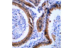 Immunohistochemical analysis of VASP staining in human tonsil formalin fixed paraffin embedded tissue section.