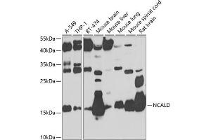Western blot analysis of extracts of various cell lines, using NCALD antibody (ABIN6132891, ABIN6144390, ABIN6144391 and ABIN6224019) at 1:1000 dilution. (NCALD Antikörper  (AA 1-193))