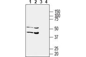 Western blot analysis of human HT-29 colorectal adenocarcinoma (lanes 1 and 3) and human HepG2 liver hepatome (lanes 2 and 4) cell lysates: - 1,2. (Solute Carrier Family 17 (Acidic Sugar Transporter), Member 5 (SLC17A5) (AA 479-492), (C-Term), (Intracellular) Antikörper)