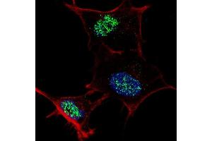 Fluorescent confocal image of SY5Y cells stained with f KLF4  antibody. (KLF4 Antikörper  (AA 481-504))