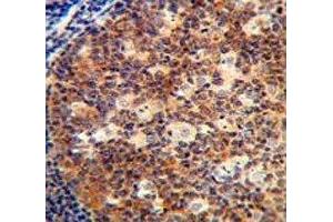 IL-12B antibody immunohistochemistry analysis in formalin fixed and paraffin embedded human tonsil tissue. (IL12B Antikörper  (AA 264-290))