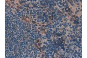 Immunohistochemistry (IHC) image for anti-E3 ubiquitin-protein ligase MIB2 (MIB2) (AA 546-784) antibody (ABIN7439507)