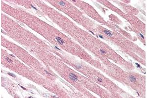 Human Heart (formalin-fixed, paraffin-embedded) stained with CASP1 antibody ABIN461892 at 5 ug/ml followed by biotinylated goat anti-rabbit IgG secondary antibody ABIN481713, alkaline phosphatase-streptavidin and chromogen. (Caspase 1 Antikörper)