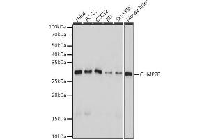 Western blot analysis of extracts of various cell lines, using CHMP2B antibody (ABIN7266290) at 1:1000 dilution. (CHMP2B Antikörper)