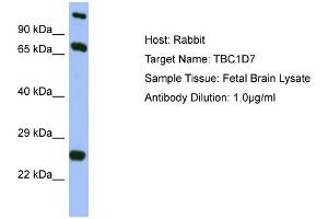 Host: Rabbit Target Name: TBC1D7 Sample Type: Fetal Brain lysates Antibody Dilution: 1. (TBC1D7 Antikörper  (Middle Region))