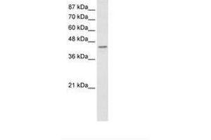 Image no. 1 for anti-Poly(rC) Binding Protein 4 (PCBP4) (AA 197-246) antibody (ABIN6736235)