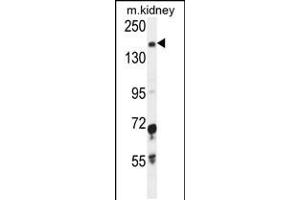 Western blot analysis in mouse kidney tissue lysates (35ug/lane). (IGSF1 Antikörper  (C-Term))