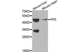 Western blot analysis of extracts of various tissues, using HFE antibody. (HFE Antikörper  (AA 80-306))