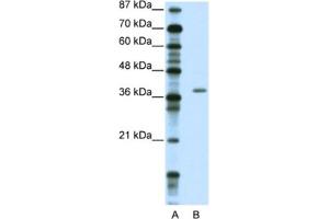 Western Blotting (WB) image for anti-Zinc Finger Protein 444 (ZNF444) antibody (ABIN2461893)