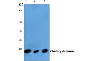 Western blot (WB) analysis of CCK antibody at 1/500 dilution (Cholecystokinin Antikörper)