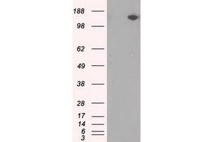 Western Blotting (WB) image for anti-PAS Domain Containing Serine/threonine Kinase (PASK) antibody (ABIN1500033)