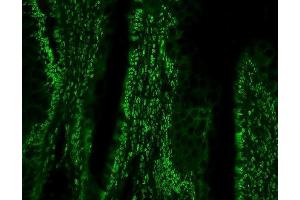 IF analysis of PTBP1 using anti-PTBP1 antibody (ABIN7599450). (PTBP1 Antikörper  (AA 1-504))