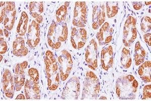 Immunohistochemistry of paraffin-embedded Human stomach using Cytochrome c1 Polyclonal Antibody at dilution of 1:100(400x) (Cytochrome C1 Antikörper)