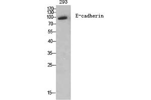 Western Blot analysis of various cells using E-cadherin Polyclonal Antibody diluted at 1:2000. (E-cadherin Antikörper  (AA 810-890))