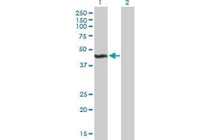 Western Blot analysis of ALG2 expression in transfected 293T cell line by ALG2 MaxPab polyclonal antibody. (ALG2 Antikörper  (AA 1-416))