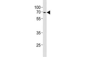 Western blot analysis of lysate from mouse heart tissue lysate using Klf4 antibody at 1:1000.