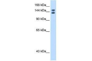 WB Suggested Anti-Mybbp1a Antibody Titration:  0.