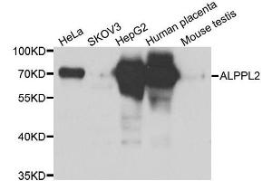 Western blot analysis of extracts of various cell lines, using ALPPL2 antibody. (ALPPL2 Antikörper  (AA 20-280))