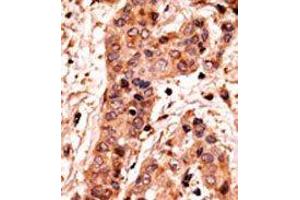 Image no. 2 for anti-Guanylate Cyclase 1, Soluble, alpha 2 (GUCY1A2) (C-Term) antibody (ABIN360707)