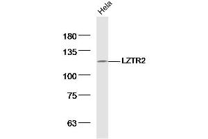 Hela lysates probed with LZTR2 Polyclonal Antibody, Unconjugated  at 1:300 dilution and 4˚C overnight incubation.