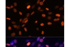 Immunofluorescence analysis of NIH/3T3 cells using TriMethyl-Histone H3-K27 Polyclonal Antibody at dilution of 1:100.