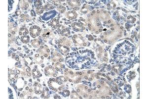 Immunohistochemistry (IHC) image for anti-Phosphoribosyl Pyrophosphate Amidotransferase (PPAT) (N-Term) antibody (ABIN2782471)