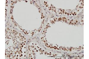 Immunoperoxidase of monoclonal antibody to SMARCB1 on formalin-fixed paraffin-embedded human testis. (SMARCB1 Antikörper  (AA 81-180))