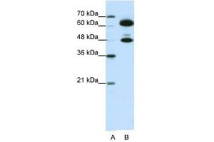 SNRP70 antibody used at 0. (SNRNP70 Antikörper)