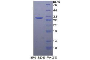 SDS-PAGE analysis of Human vWA1 Protein. (VWA1 Protein)