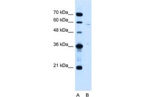 Western Blotting (WB) image for anti-MGC39633 antibody (ABIN2463995) (MGC39633 Antikörper)