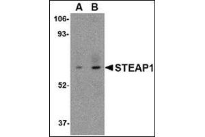Western blot analysis of STEAP1 in human spleen tissue lysate with this product at (A) 1 and (B) 2 μg/ml. (STEAP1 Antikörper  (C-Term))