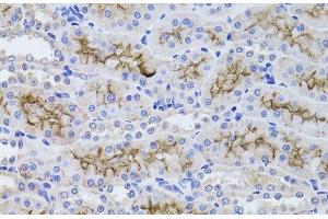 Immunohistochemistry of paraffin-embedded Rat kidney using GGT1 Polyclonal Antibody at dilution of 1:100 (40x lens). (GGT1 Antikörper)