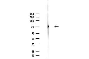 anti-Dolichol Kinase (DOLK) antibody