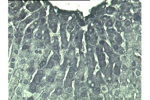 Poly(ADP-ribose) staining of rat liver. (pADPR Antikörper)