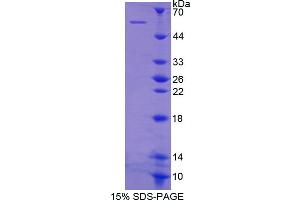 SDS-PAGE analysis of Human Integrin beta 1 Protein. (ITGB1 Protein)